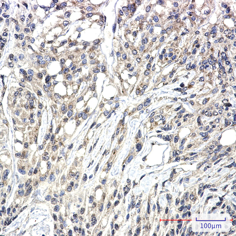 Phospho-PKC zeta/lambda (Thr410/Thr412) Rabbit mAb ABZ4570