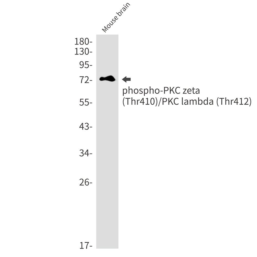 Phospho-PKC zeta/lambda (Thr410/Thr412) Rabbit mAb ABZ4570