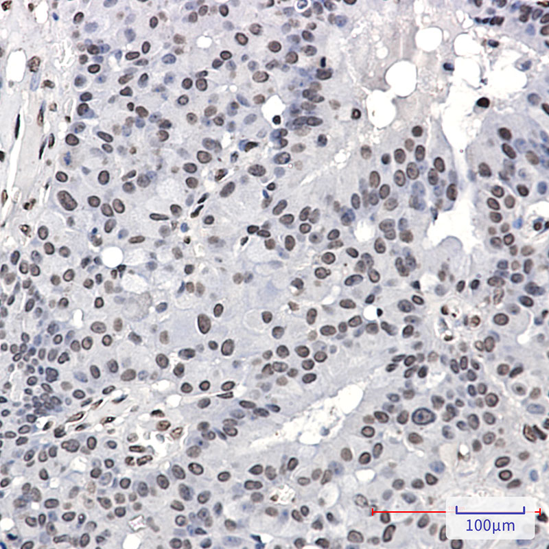 Phospho-PML Protein (Ser518) Rabbit mAb ABZ4571