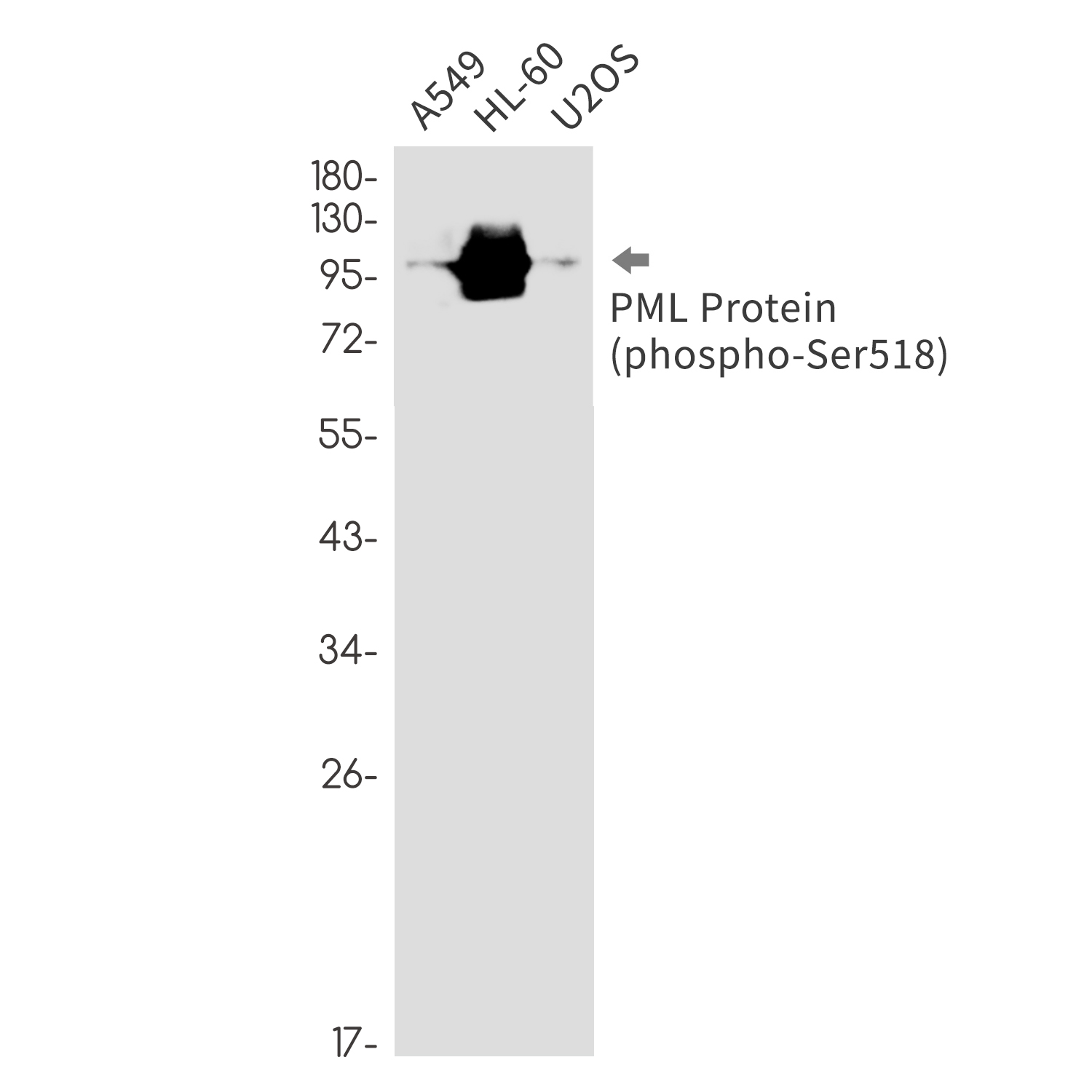 Phospho-PML Protein (Ser518) Rabbit mAb ABZ4571