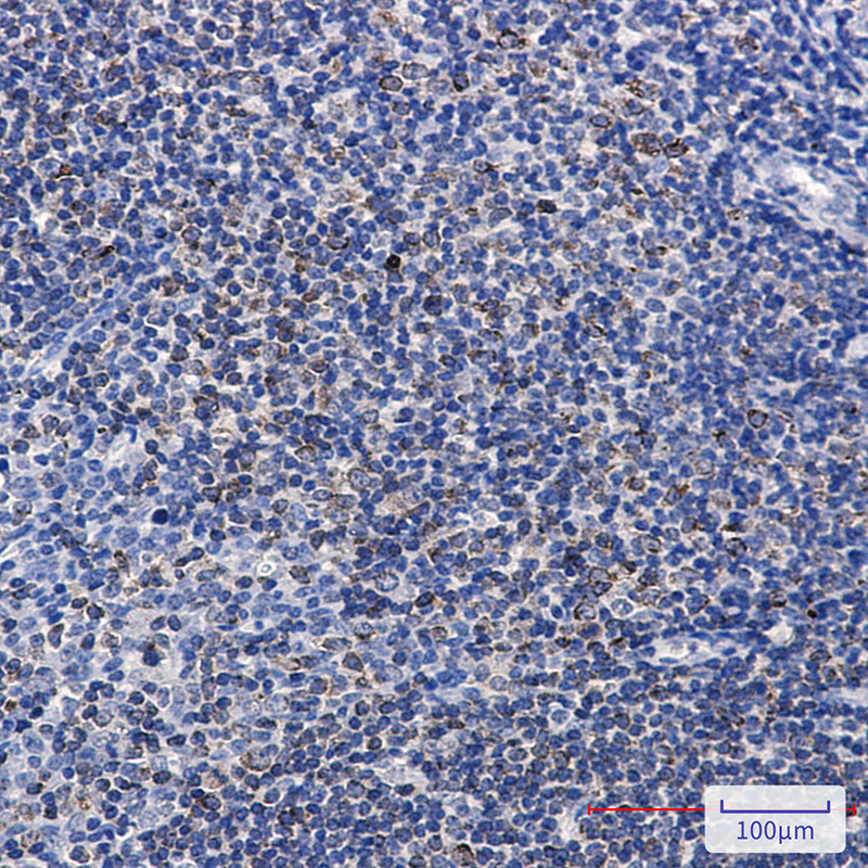 Phospho-PTP1B (Ser378) Rabbit mAb ABZ4572