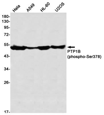 Phospho-PTP1B (Ser378) Rabbit mAb ABZ4572