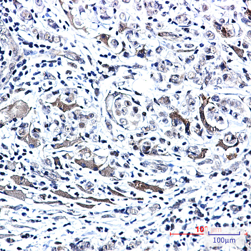 Phospho-PTS (Ser19) Rabbit mAb ABZ4573