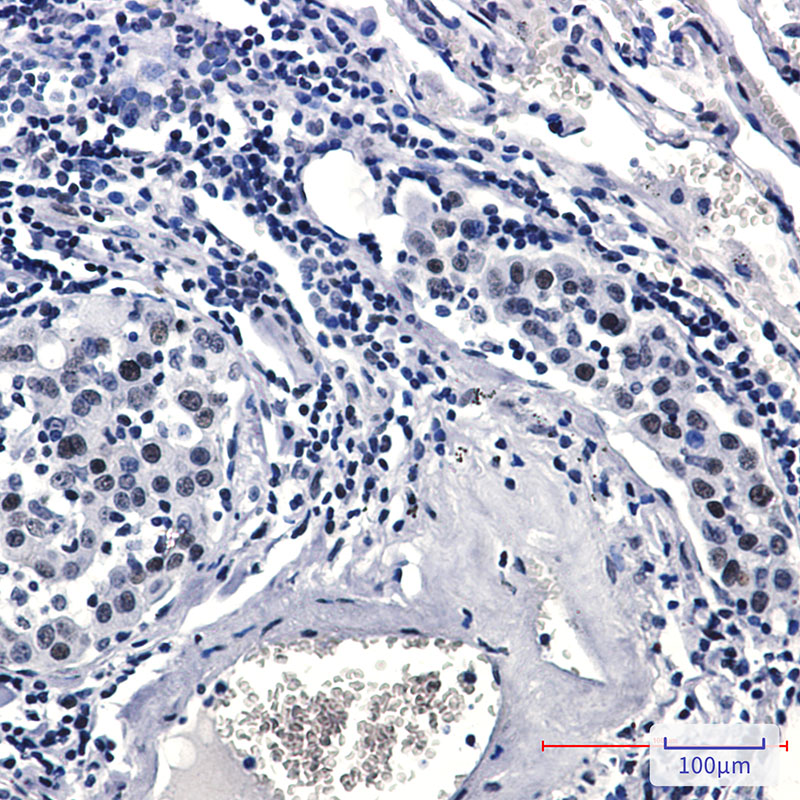 Phospho-Rad17 (Ser656) Rabbit mAb ABZ4574