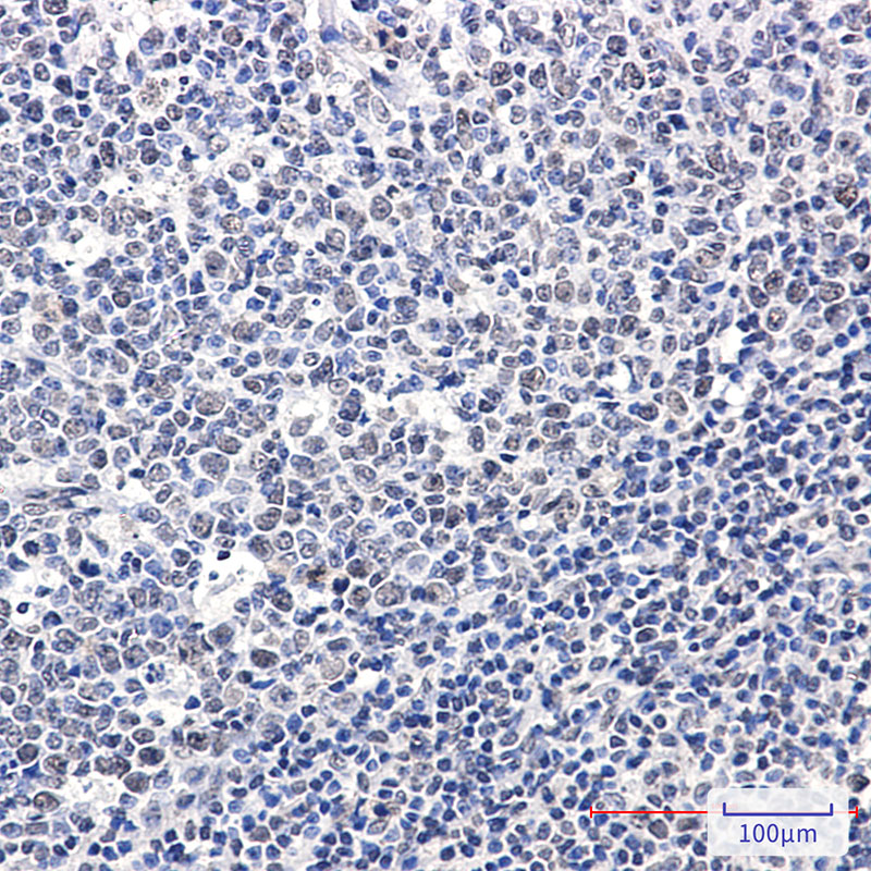 Phospho-Rb (Ser608) Rabbit mAb ABZ4575