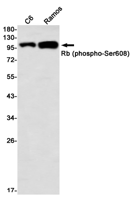 Phospho-Rb (Ser608) Rabbit mAb ABZ4575