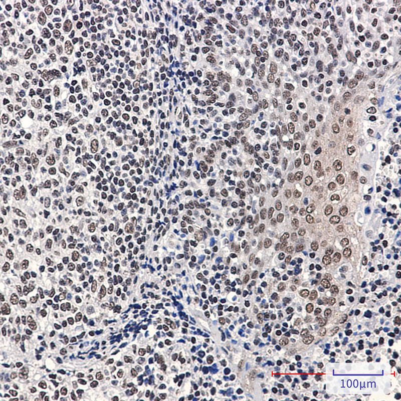 Phospho-Rb (Ser780) Rabbit mAb ABZ4576