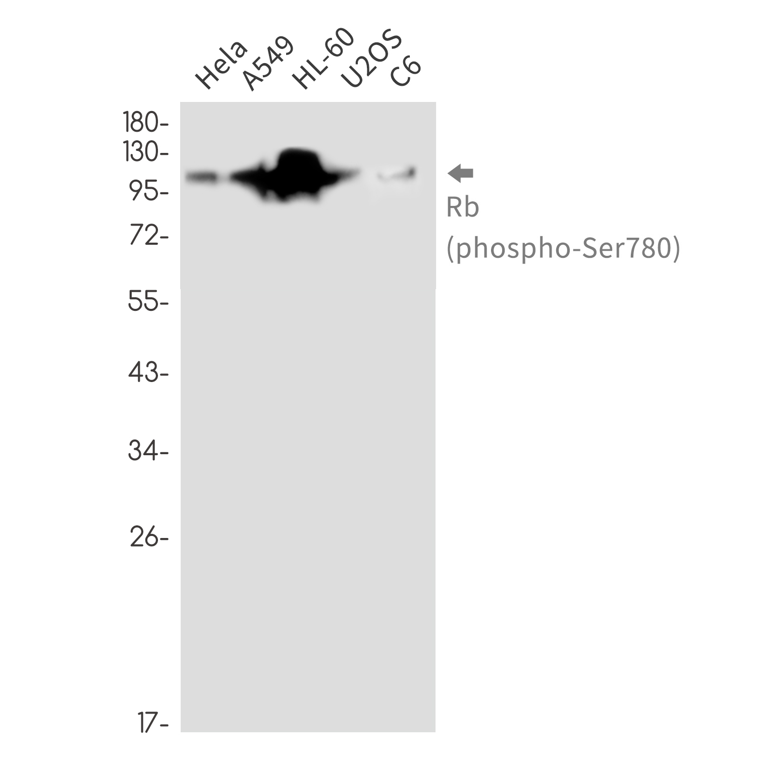 Phospho-Rb (Ser780) Rabbit mAb ABZ4576