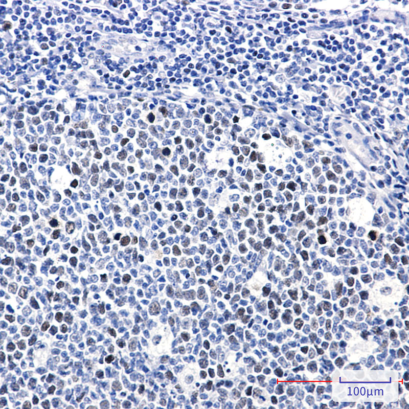 Phospho-Rb (Thr252) Rabbit mAb ABZ4577