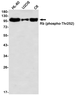 Phospho-Rb (Thr252) Rabbit mAb ABZ4577