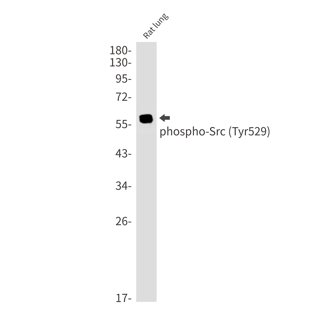 Phospho-Src (Tyr529) Rabbit mAb ABZ4579