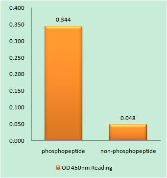 Phospho-FGFR1 (Tyr654) Rabbit pAb ABZ4582