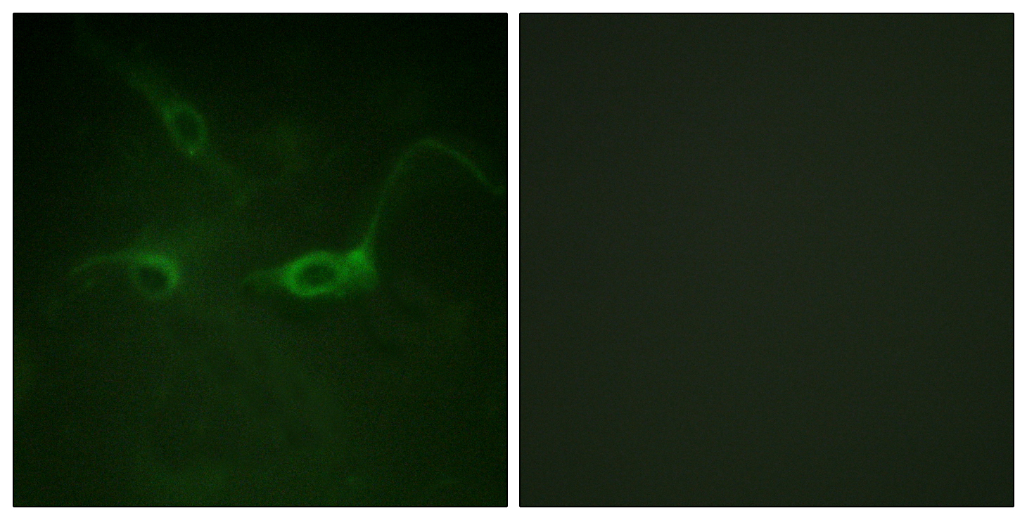 Phospho-FGFR1 (Tyr654) Rabbit pAb ABZ4582
