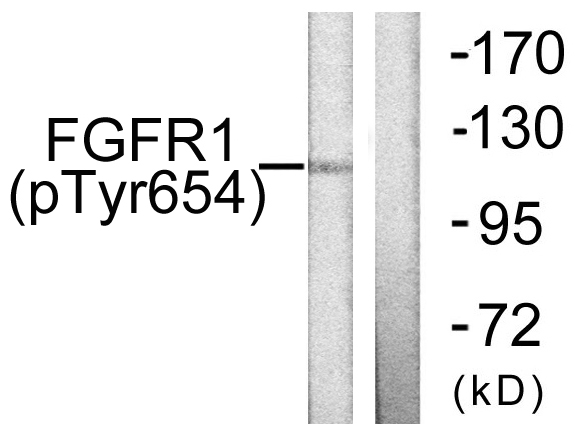 Phospho-FGFR1 (Tyr654) Rabbit pAb ABZ4582