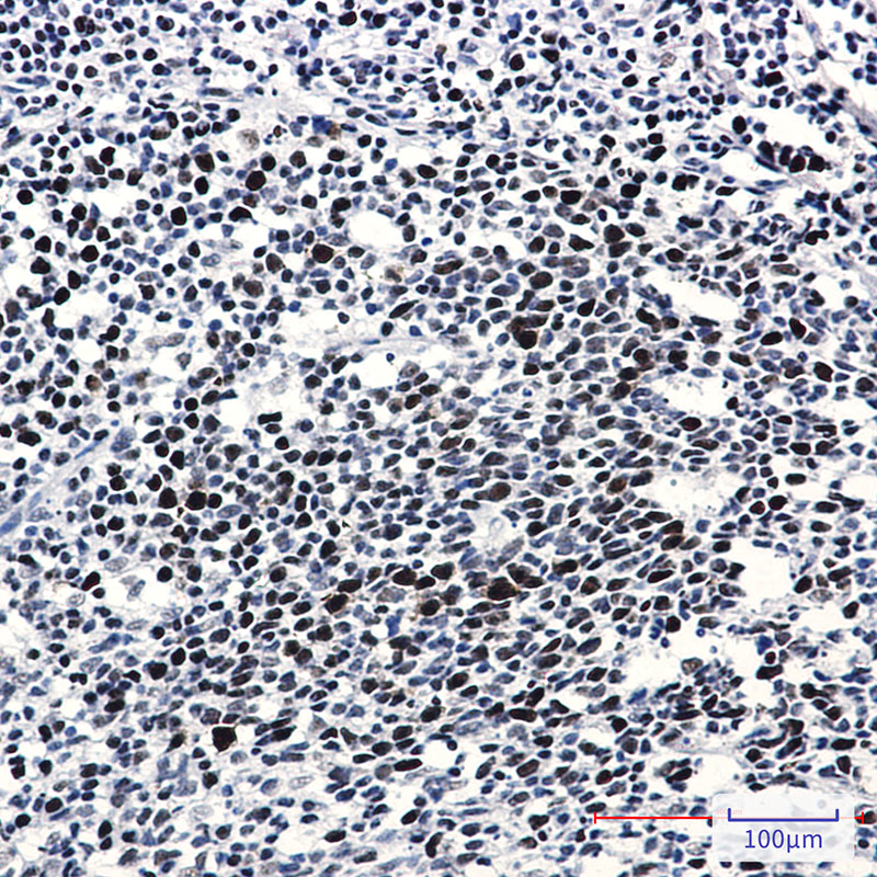 Phospho-Rb (Thr356) Rabbit mAb ABZ4587