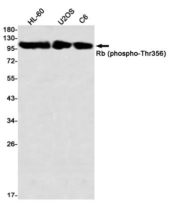 Phospho-Rb (Thr356) Rabbit mAb ABZ4587