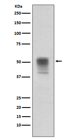 Phospho-alpha Tubulin (Tyr272) Rabbit mAb ABZ4591