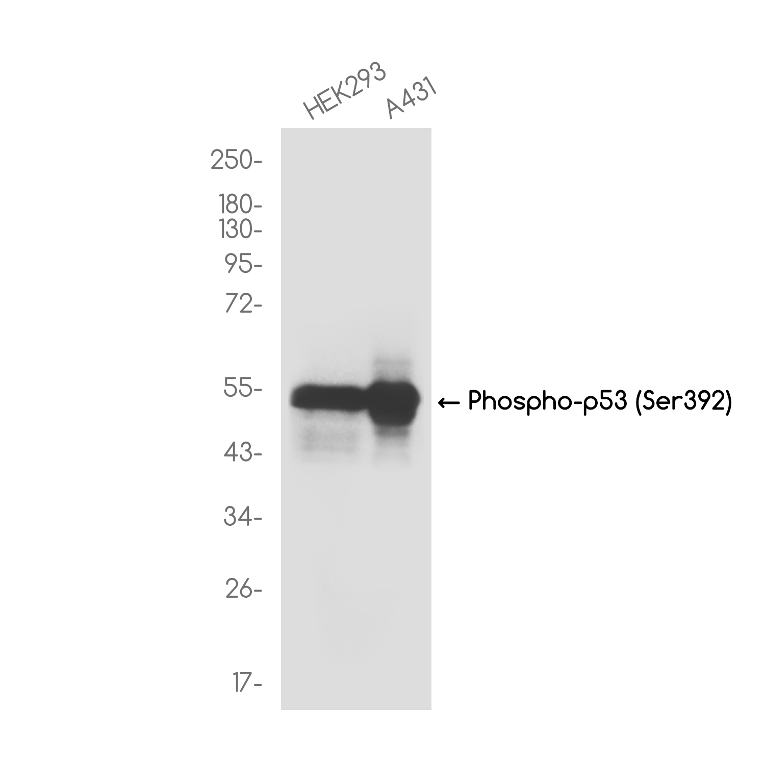 Phospho-p53 (Ser392) Rabbit mAb ABZ4592