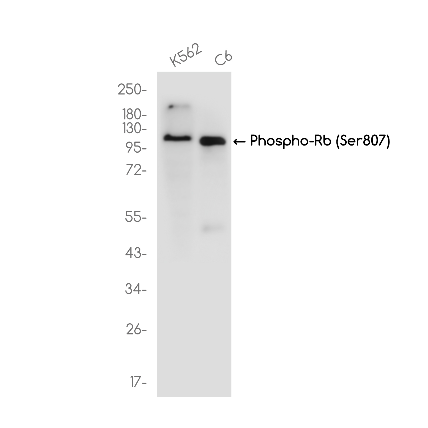 Phospho-Rb (Ser807)  Rabbit mAb ABZ4593