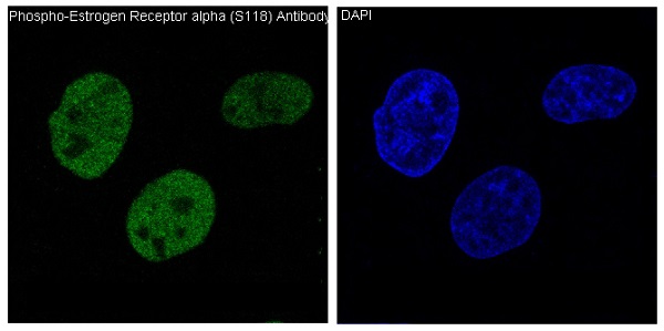 Phospho-ER alpha (Ser118) Rabbit mAb ABZ4594
