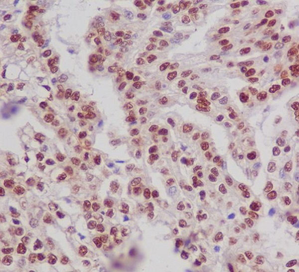 Phospho-ER alpha (Ser118) Rabbit mAb ABZ4594