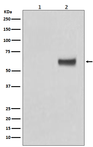 Phospho-ER alpha (Ser118) Rabbit mAb ABZ4594