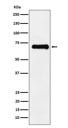 Phospho-PAK4/5/6 (Ser474/Ser560/Ser602) Rabbit mAb ABZ4595