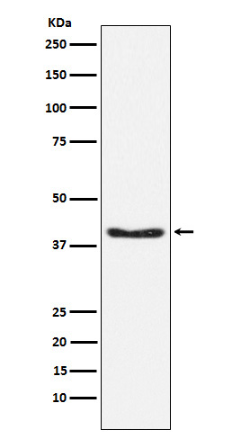 Phospho-Pyruvate Dehydrogenase E1 (Ser293) Rabbit mAb ABZ4596