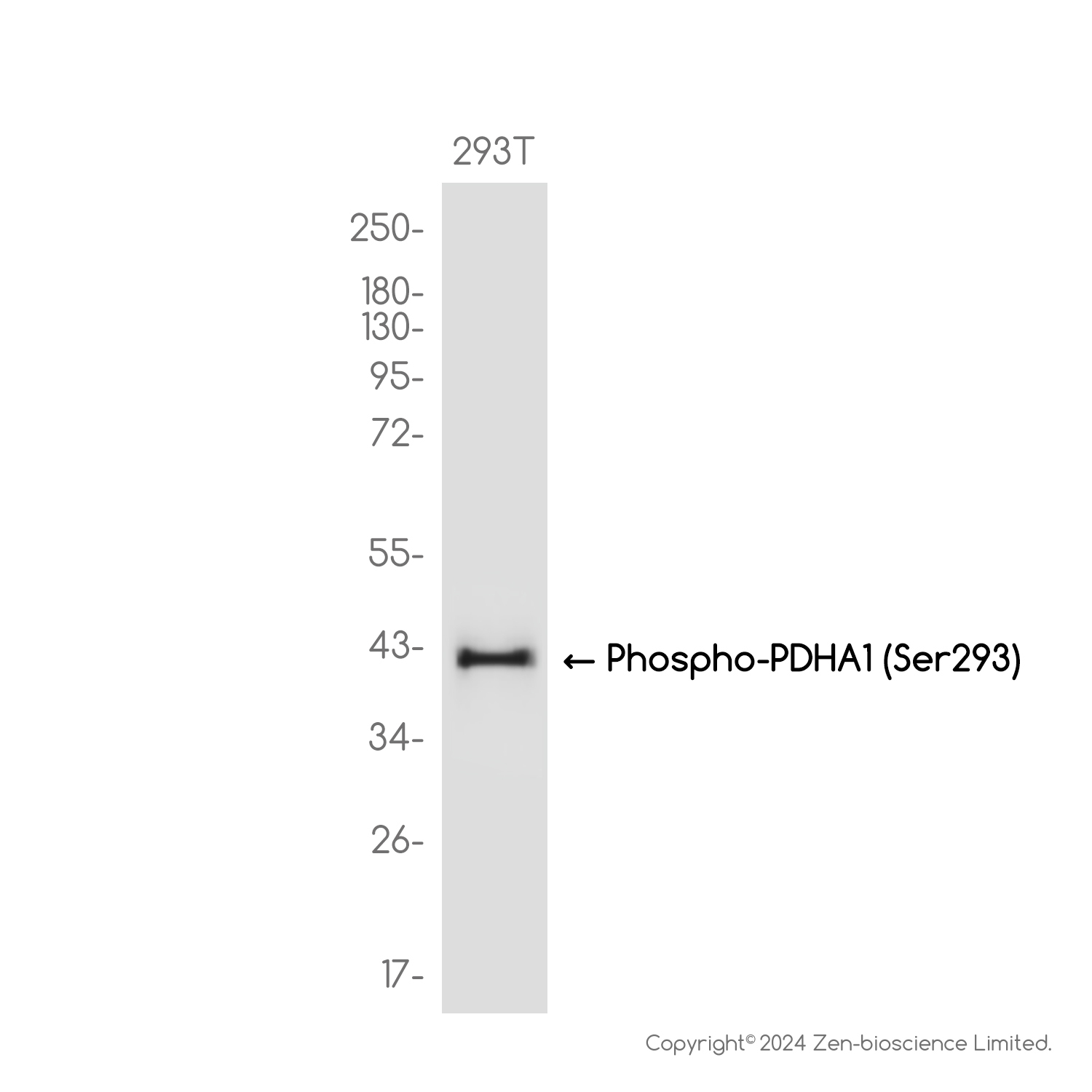Phospho-Pyruvate Dehydrogenase E1 (Ser293) Rabbit mAb ABZ4596