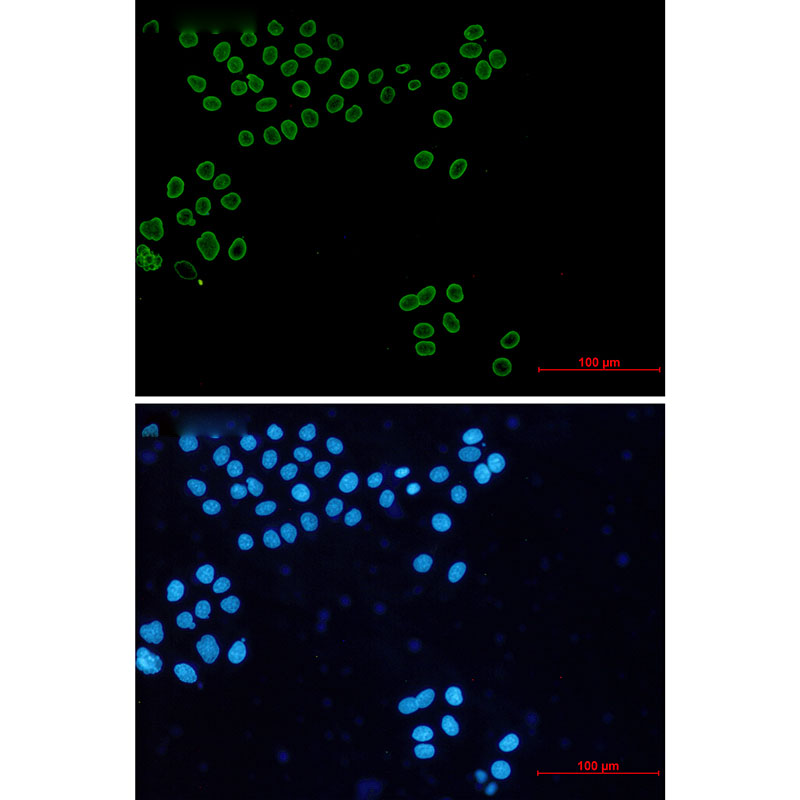 Lamin A/C Rabbit mAb ABZ4597