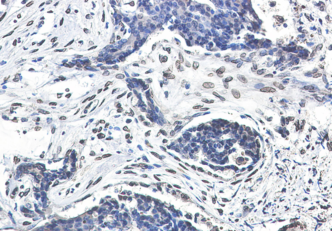 Lamin A/C Rabbit mAb ABZ4597