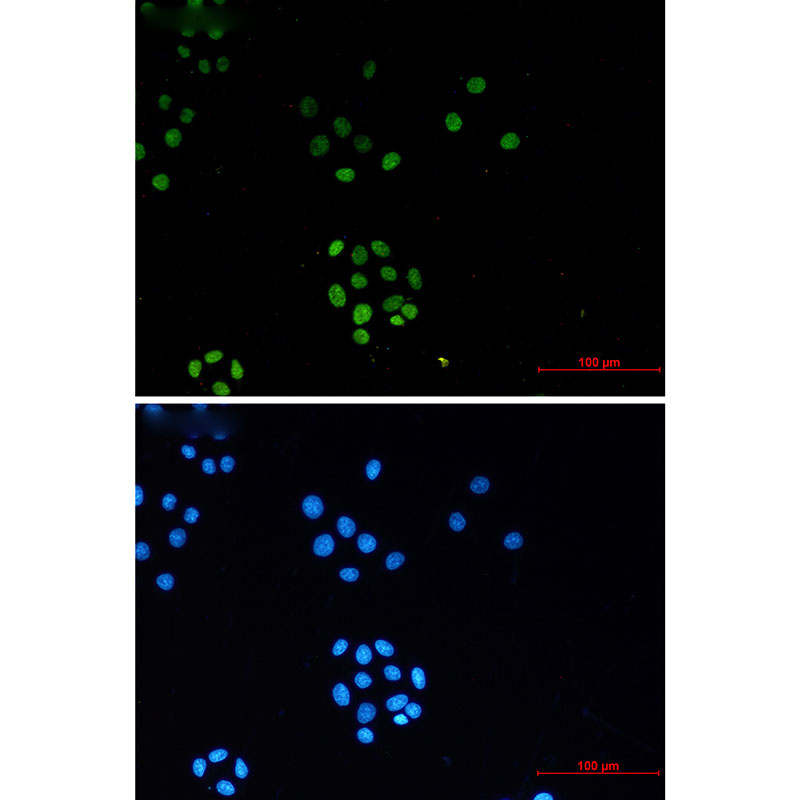 TriMethyl-Histone H3 (Lys27) Rabbit mAb ABZ4607