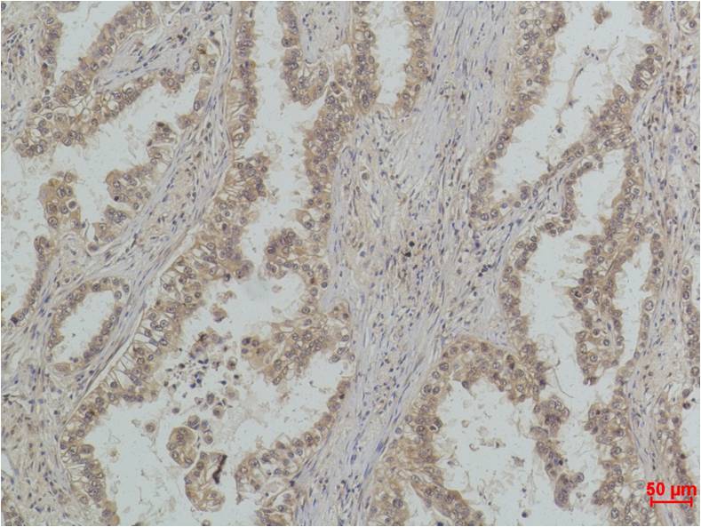 MonoMethyl-p53 (Lys370) (4C7) Mouse mAb ABZ4614