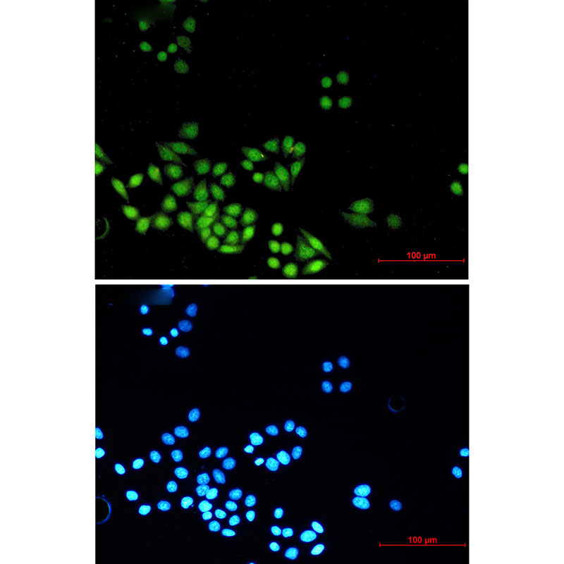 [KO]MAD2L2 Rabbit mAb ABZ4631