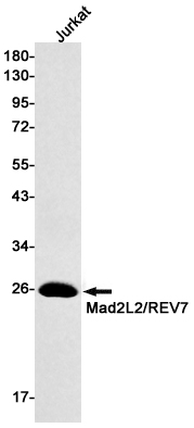 [KO]MAD2L2 Rabbit mAb ABZ4631