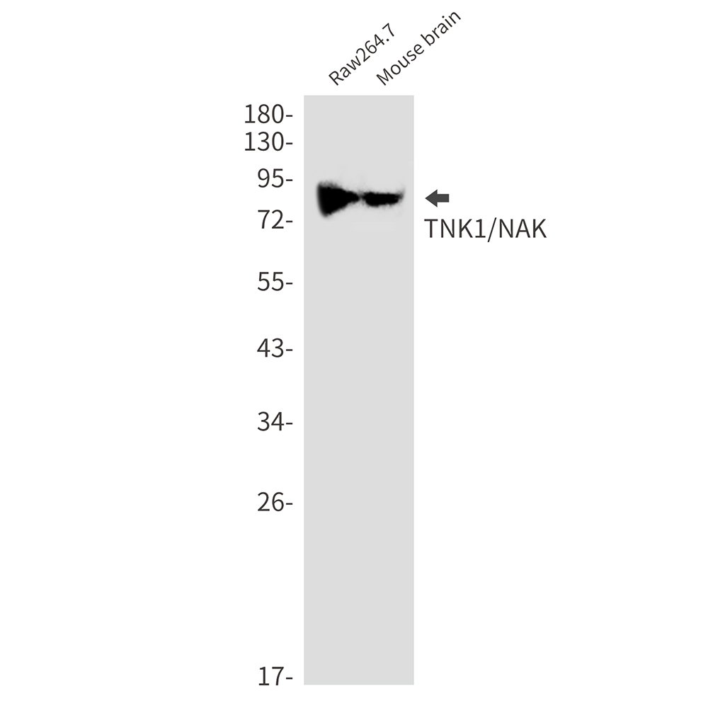 [KD]NAK/TBK1 Rabbit mAb ABZ4632