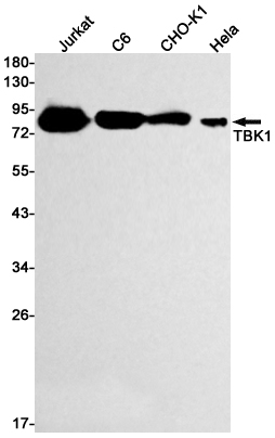 [KD]NAK/TBK1 Rabbit mAb ABZ4633