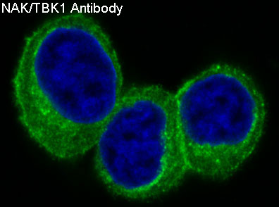 [KD]NAK/TBK1 Rabbit mAb ABZ4634