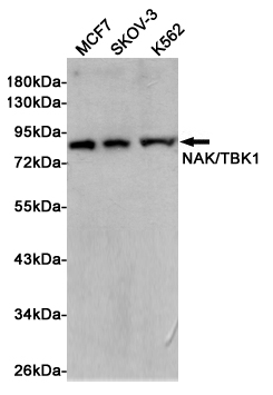 [KD]NAK/TBK1 Rabbit mAb ABZ4634