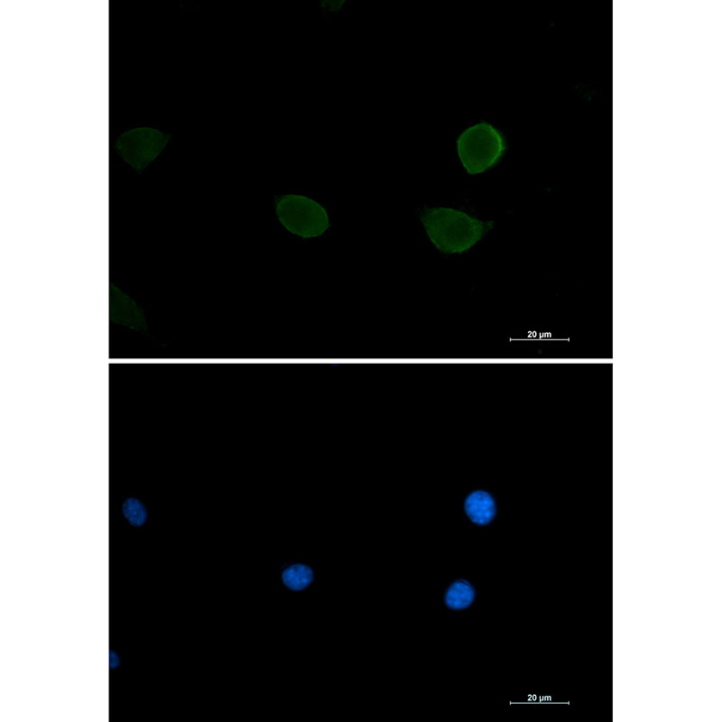 [KO]P70 S6 Kinase beta/SRK Rabbit mAb ABZ4635