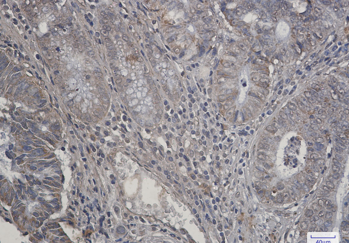 [KO]P70 S6 Kinase beta/SRK Rabbit mAb ABZ4635