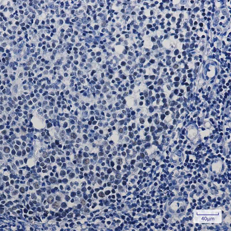 [KD]MBD2 Rabbit mAb ABZ4636
