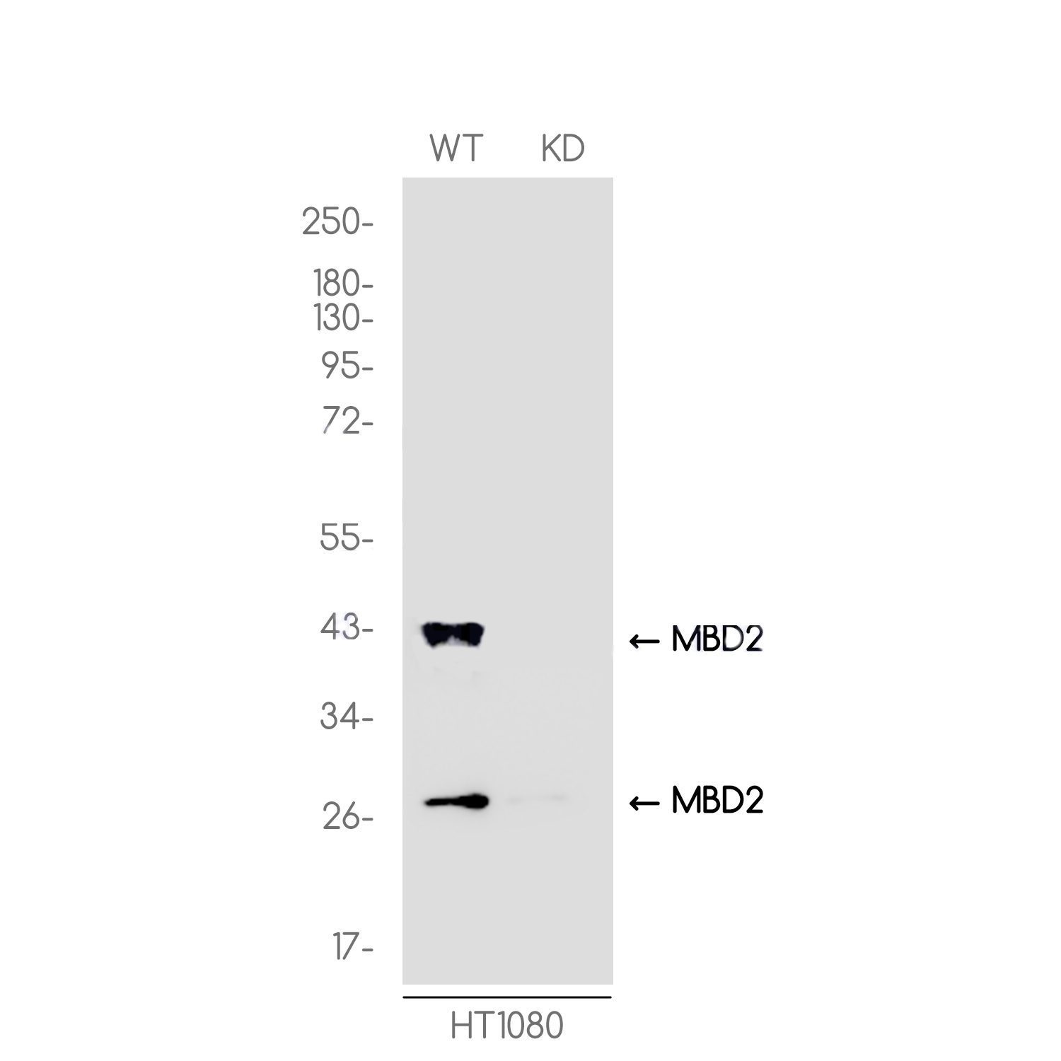 [KD]MBD2 Rabbit mAb ABZ4636