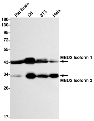 [KD]MBD2 Rabbit mAb ABZ4636
