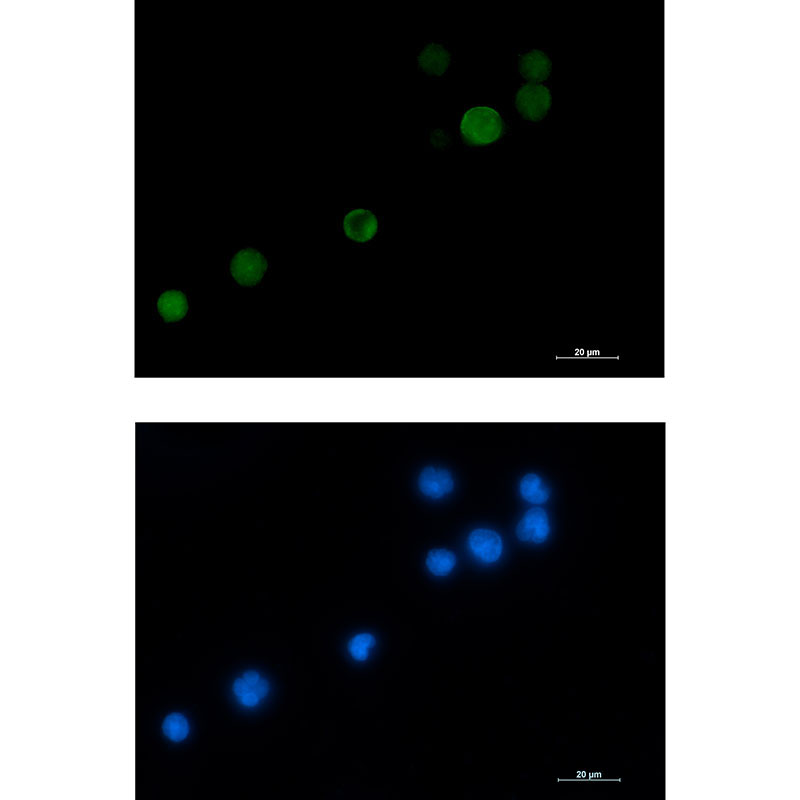 [KD]MCAK Rabbit mAb ABZ4637