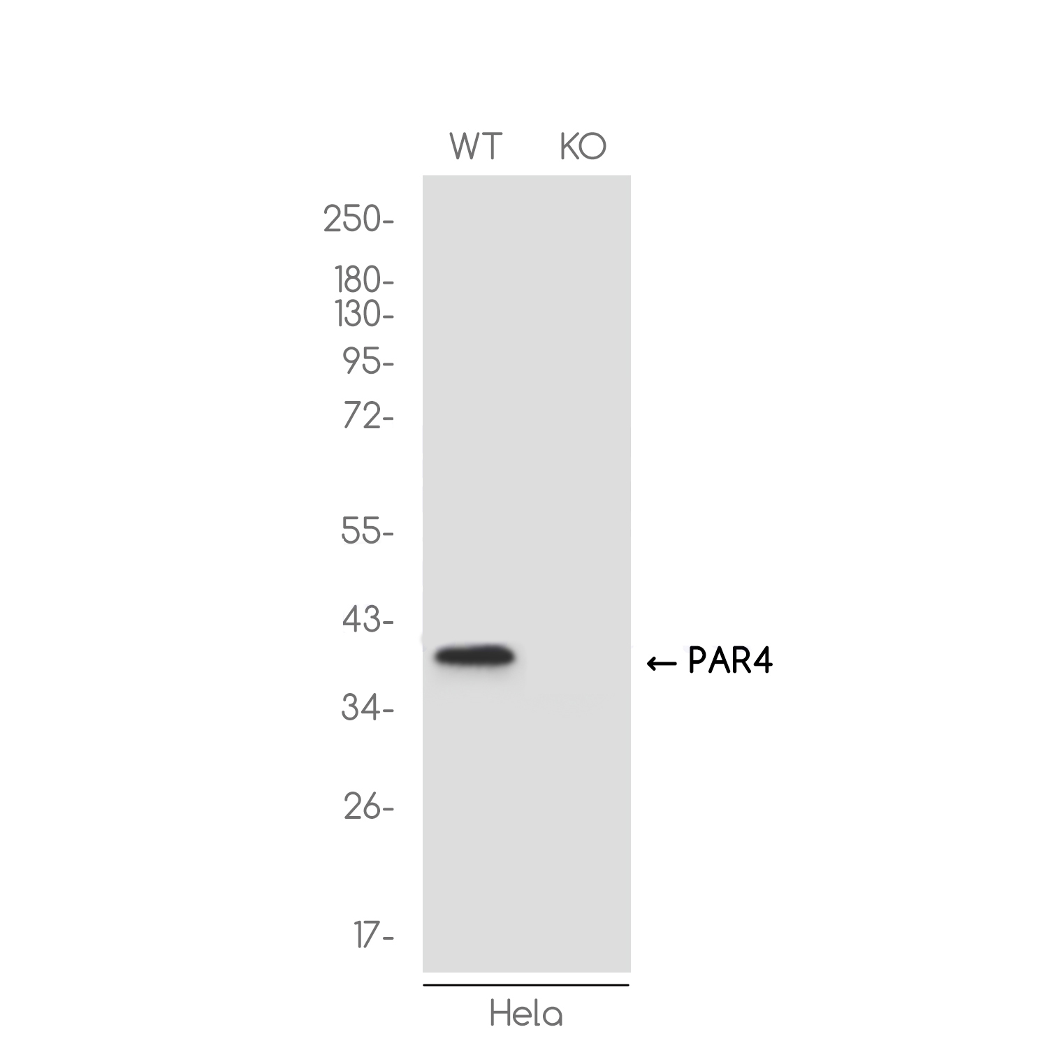 [KO]PAR4 Rabbit mAb ABZ4638