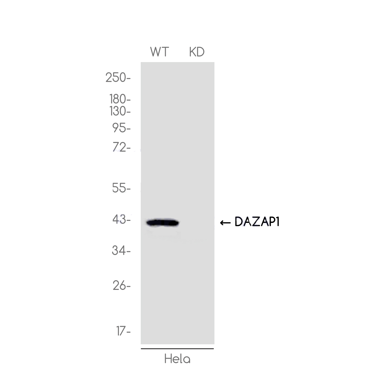 [KD]DAZAP1 Rabbit mAb ABZ4639
