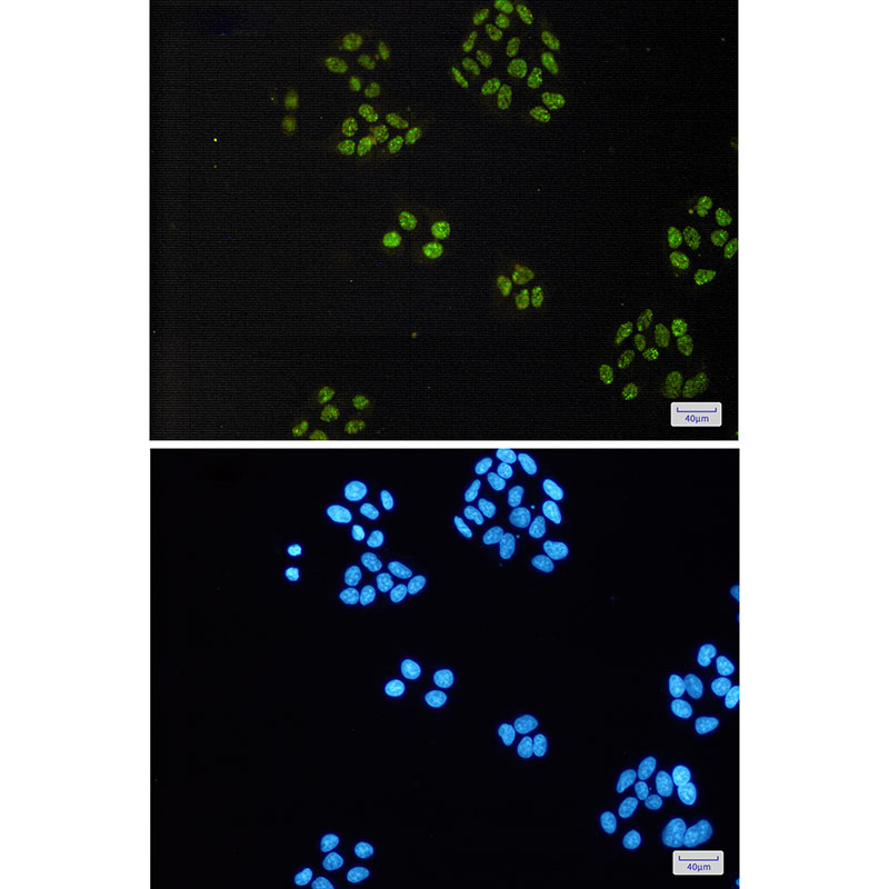 [KO]TAF15 Rabbit mAb ABZ4641