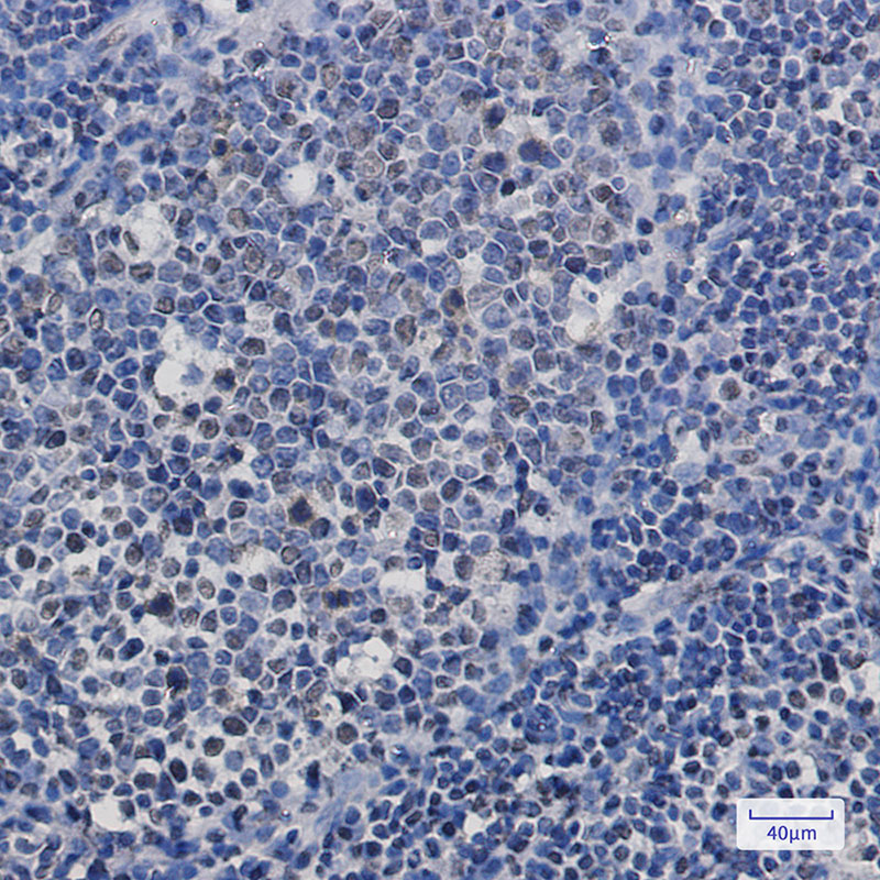 [KO]TAF15 Rabbit mAb ABZ4641