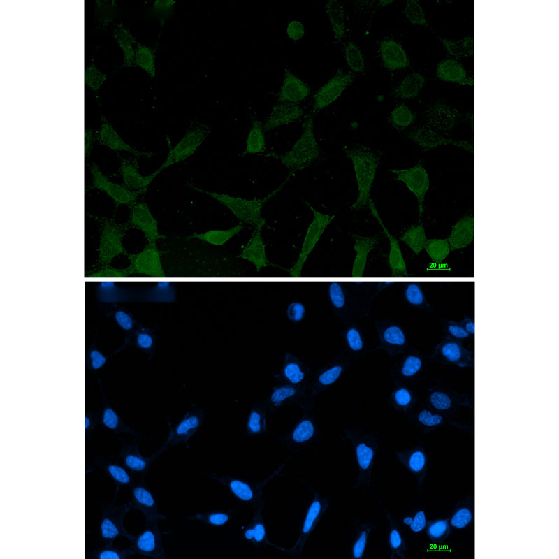 [KO]Phospho-NDRG1 (Ser330) Rabbit mAb ABZ4642